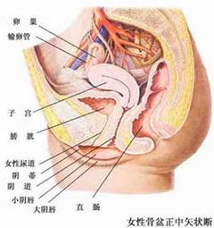 阴道整型术